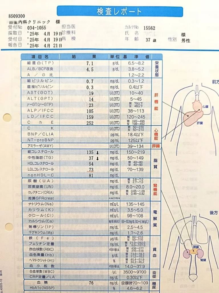 脂肪肝が改善したことを示す健康診断の検査レポート