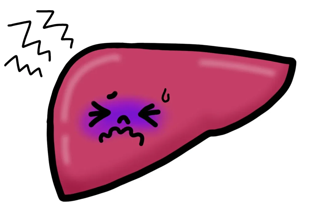 アルコールを分解するために負担がかかっている肝臓のイメージ

